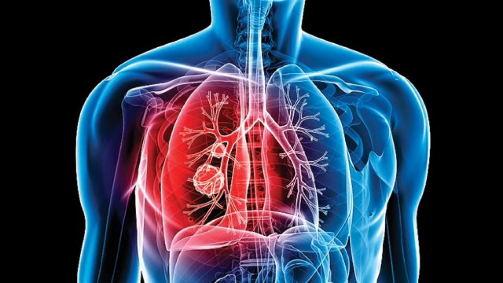 A new substance is able to cure Tuberculosis effectively